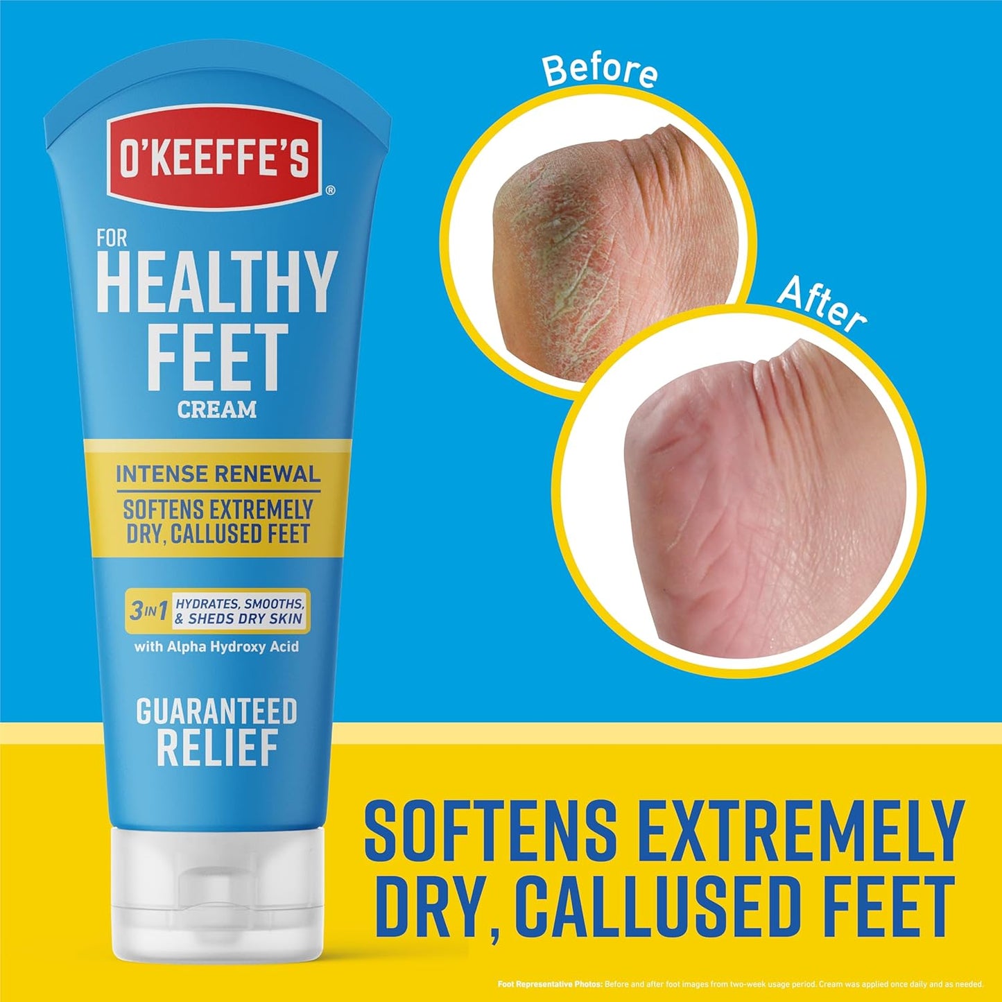 O'Keeffe's Healthy Feet Intense Renewal Cream with Alpha Hydroxy Acid