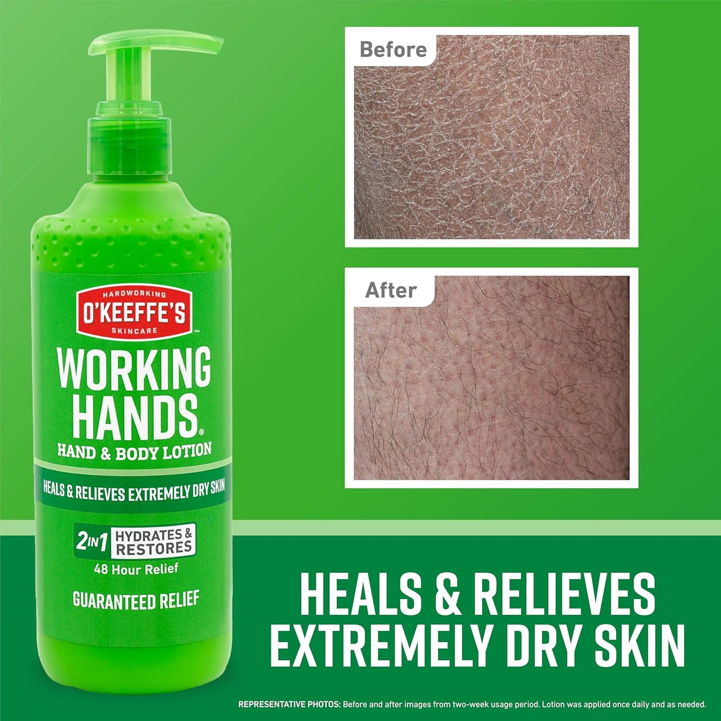 O'Keeffe's Working Hands Hand and Body Lotion